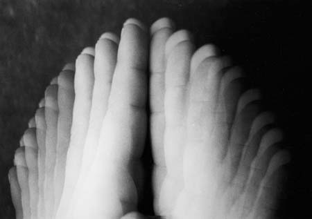 Guly�s L�szl� - F�zisok